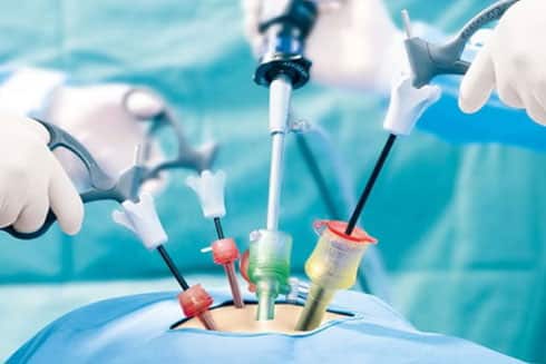 Minimal Invasive Surgery