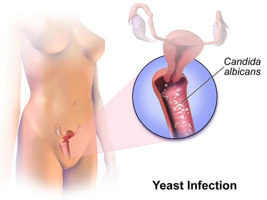Vaginal Infection Treatment in Thane