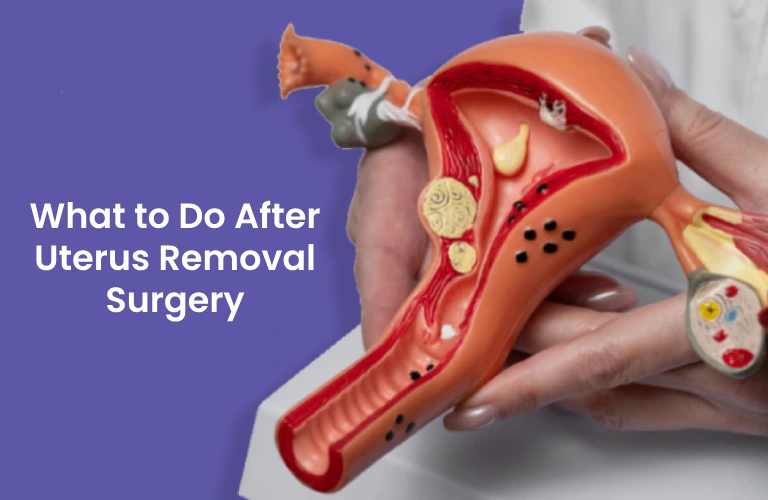 Uterus Removal Surgery