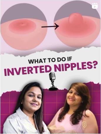What To Do If Inverted Nipples?