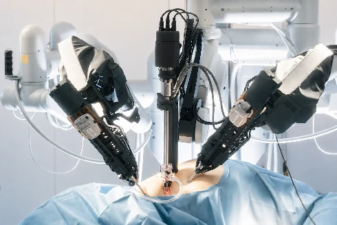 Robotic Surgery